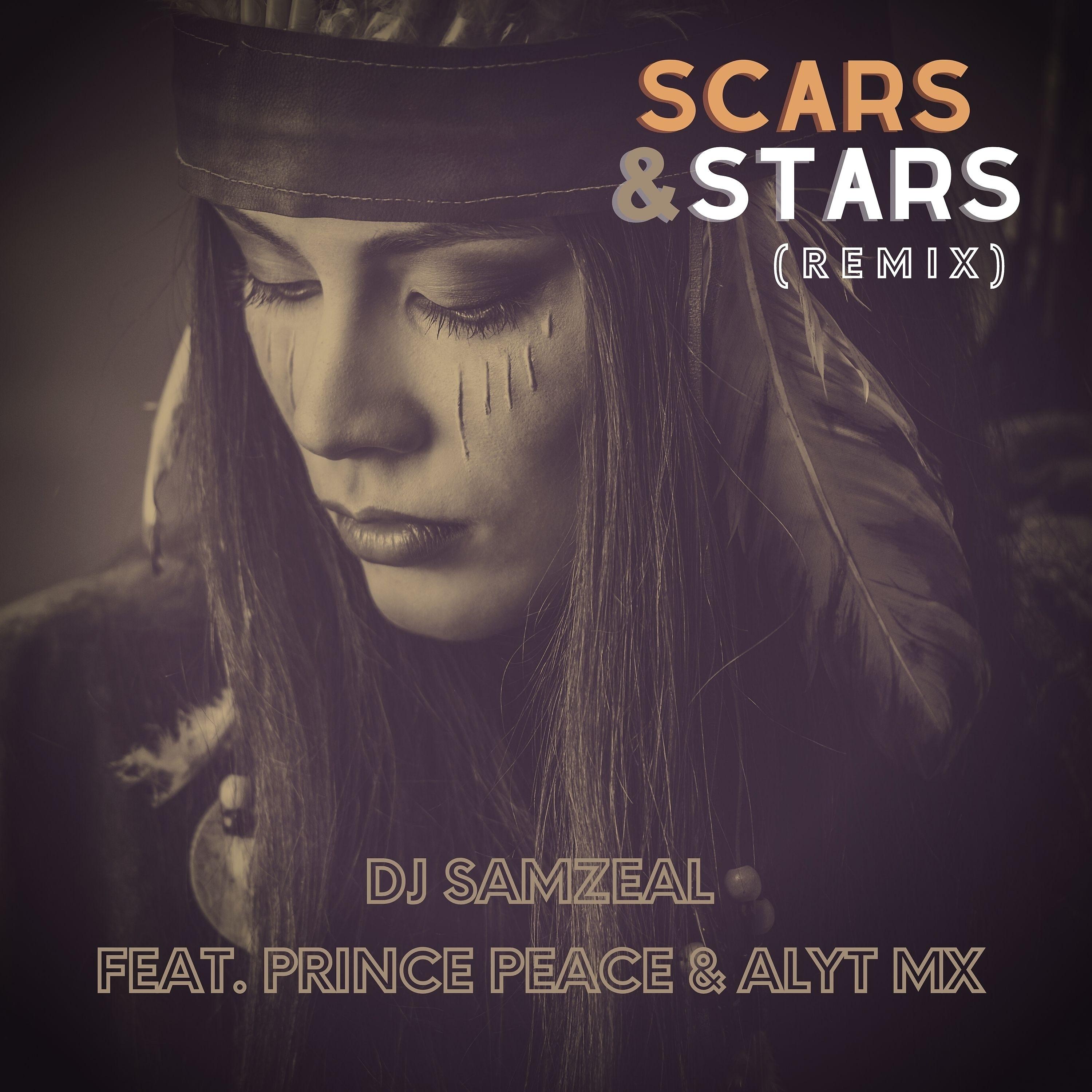 Постер альбома Scars and Stars (Remix)
