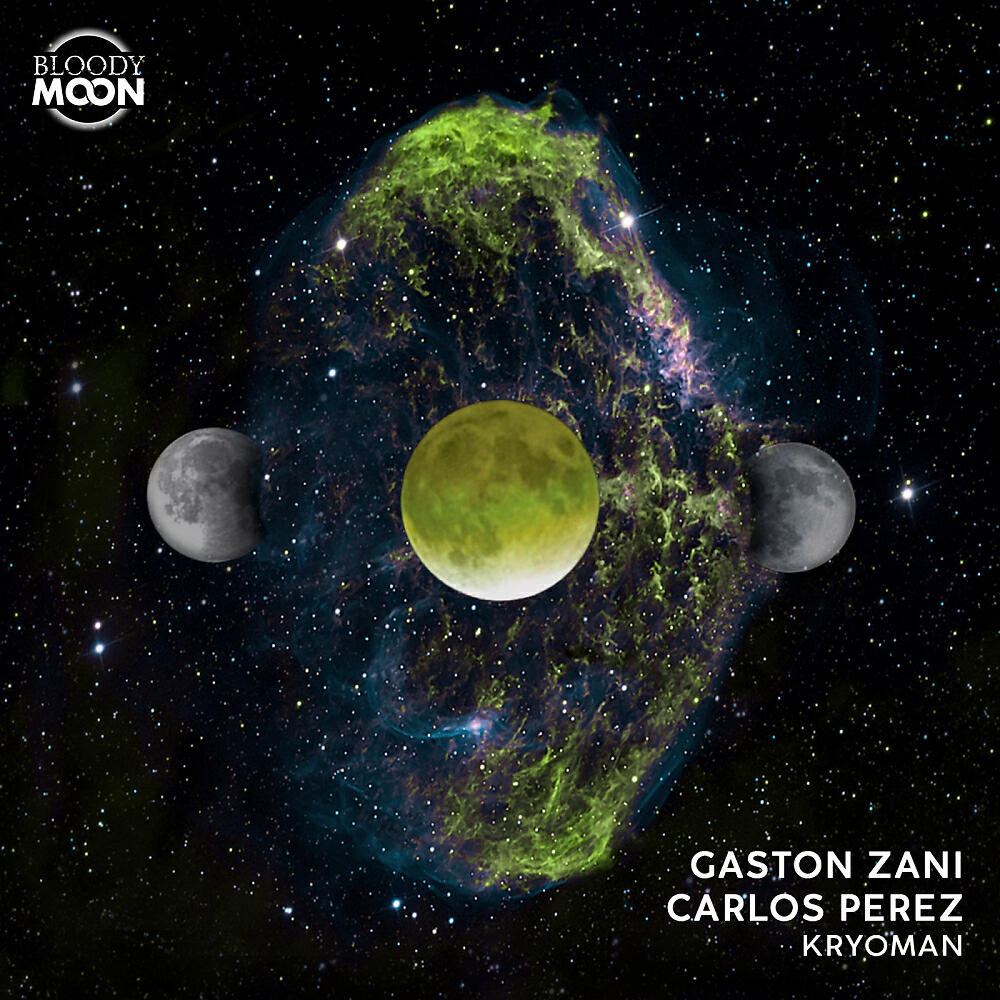 Carlos Perez - Lifelike