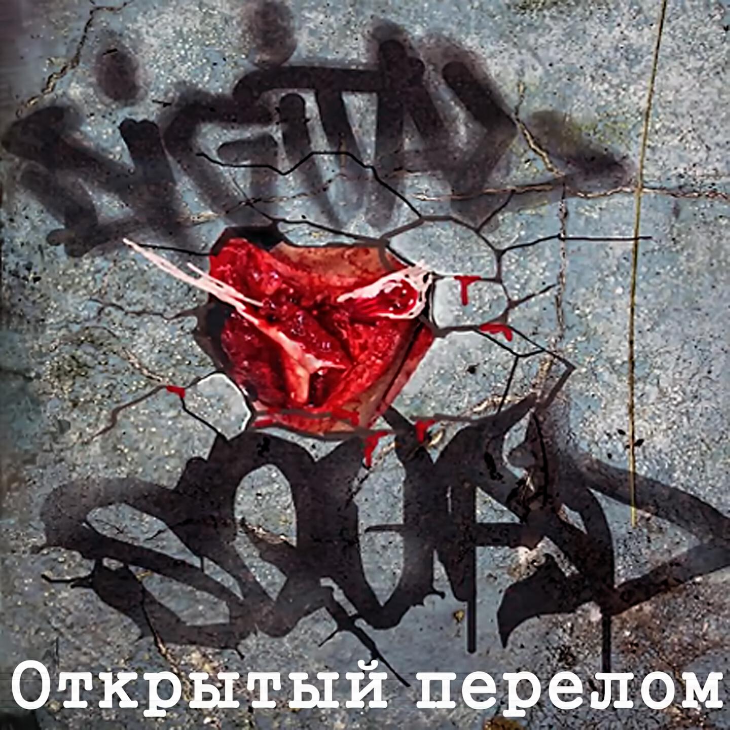 DIGITAL SQUAD - Открытый перелом