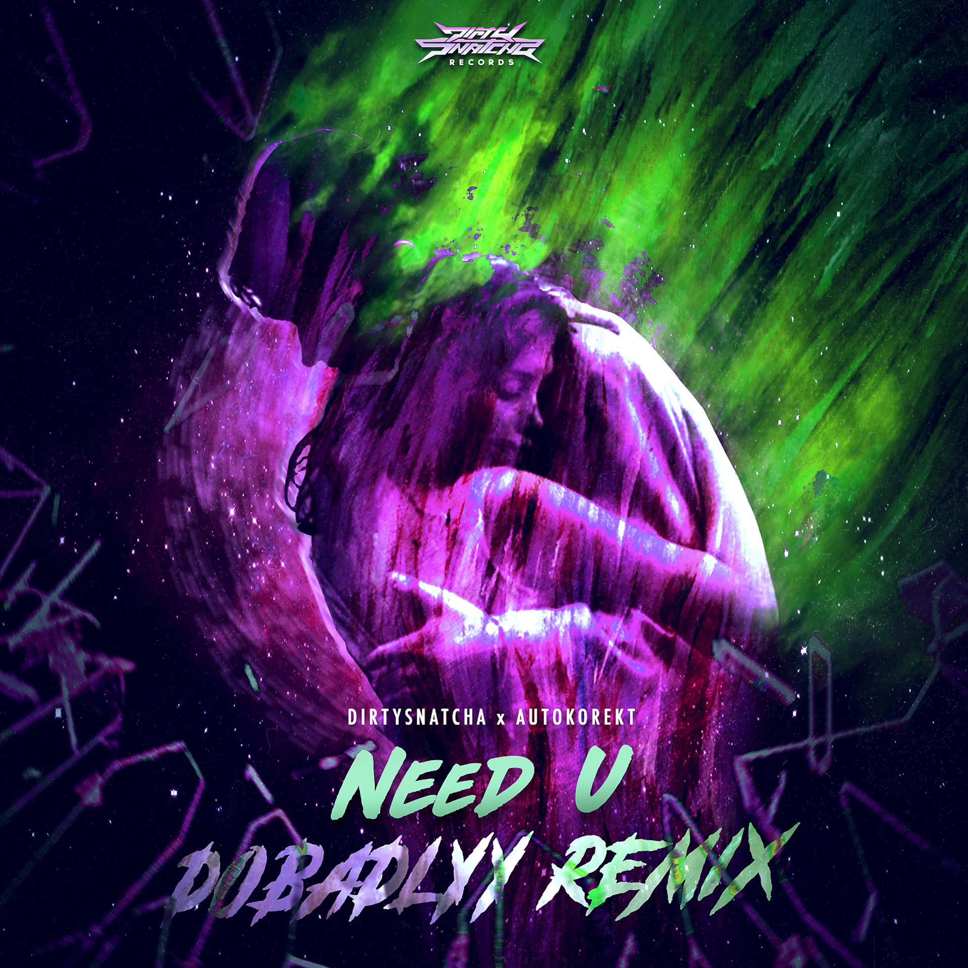 Постер альбома Need U (Dobadlyy Remix)